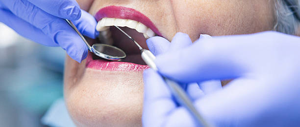 Best Emergency Tooth Extraction in Bakersfield Country Clu, CA